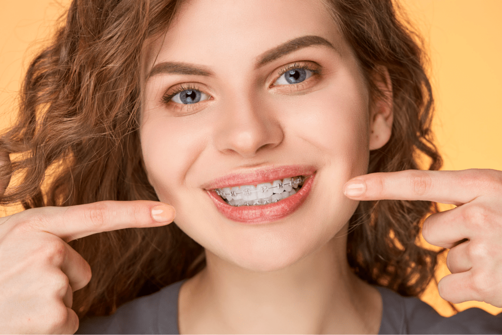 What Foods Can I eat with Braces?