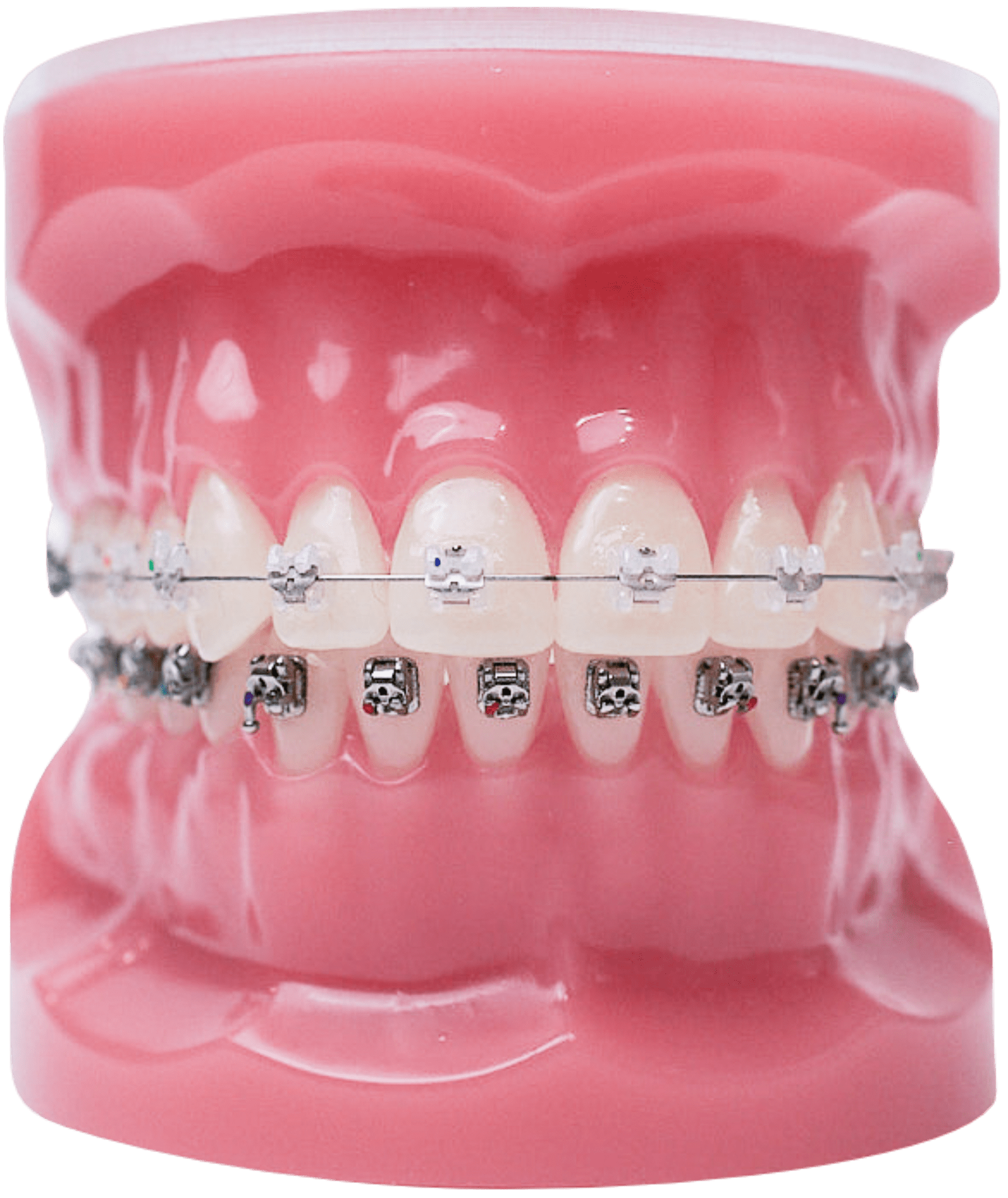 Austin Orthodontic Arts Orthodontist In Austin Braces Invisalign 5413