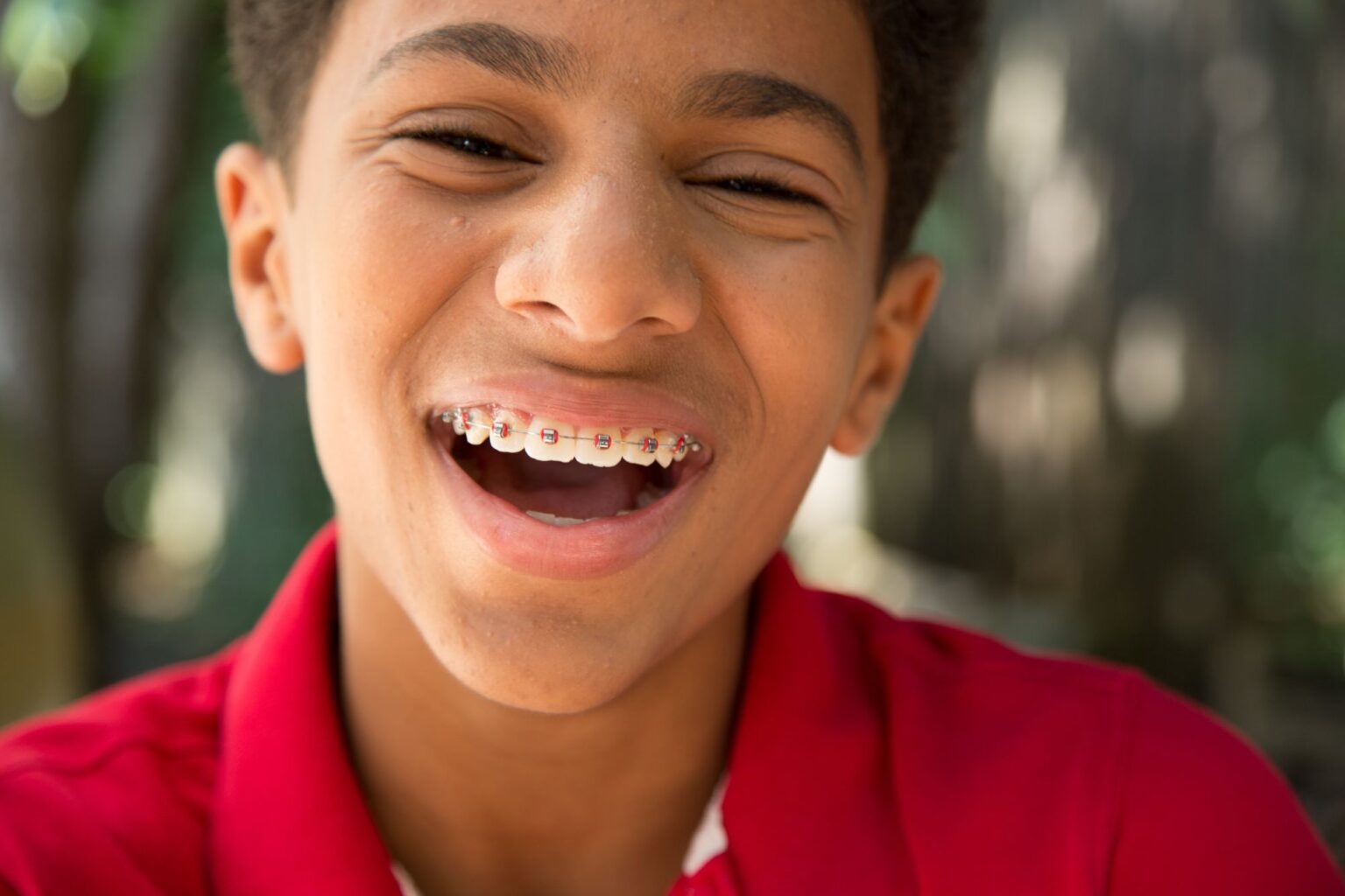 Tips for Caring for Your Metal Braces: A Complete Guide