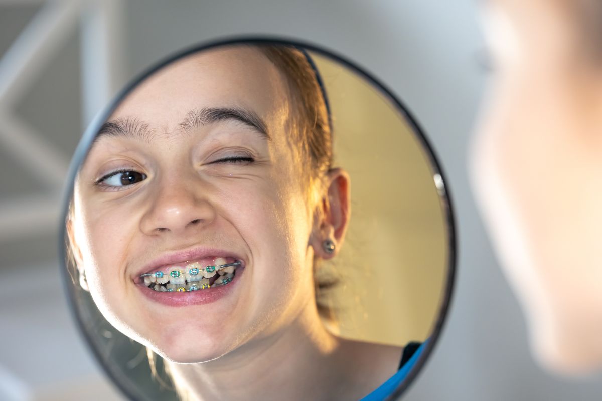 How to Keep Your Child’s Braces Clean