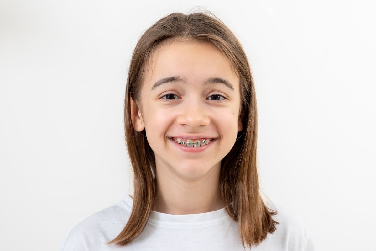 How to Tell If Your Child’s Braces Are Working