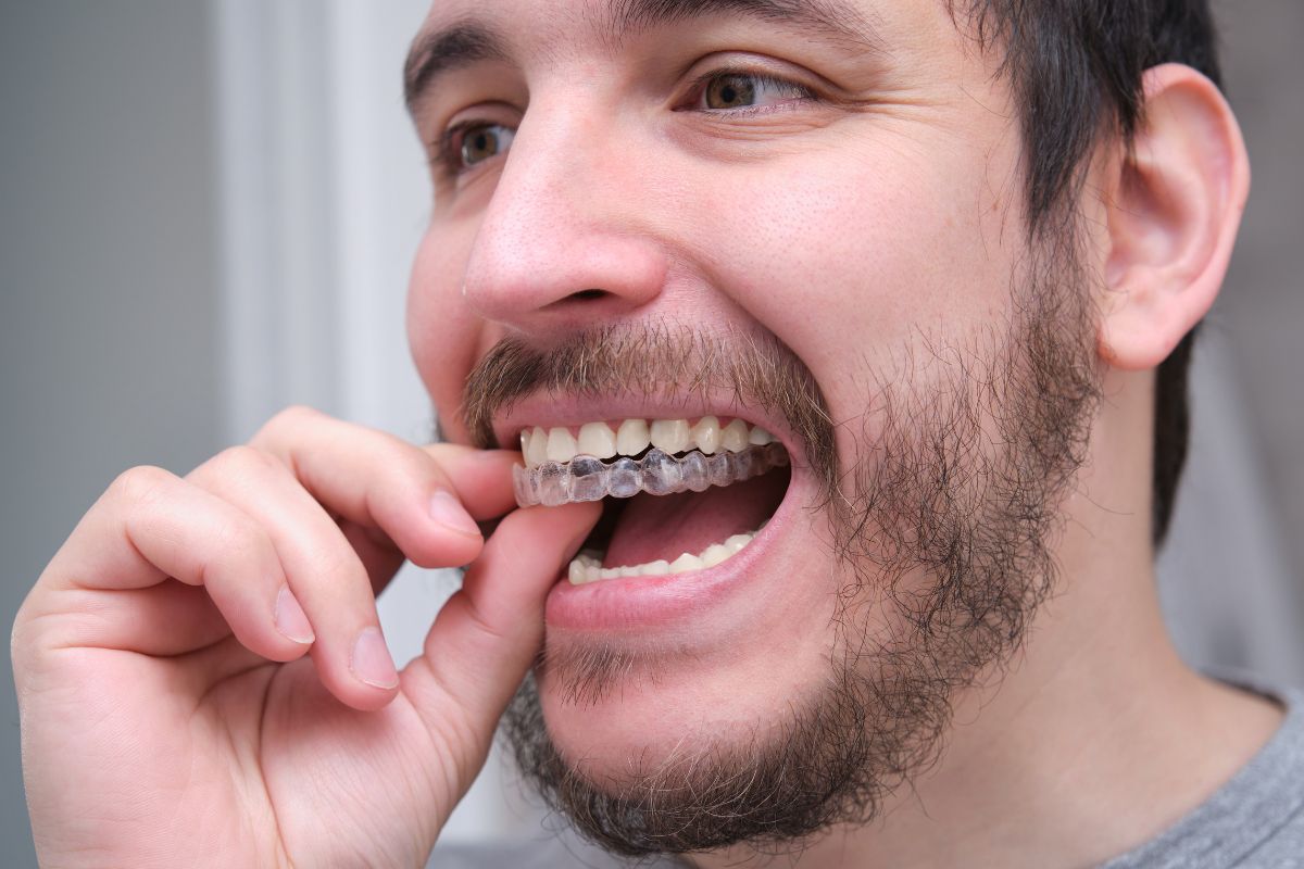 Invisalign Not Fitting Properly? Here’s What Could Be Wrong