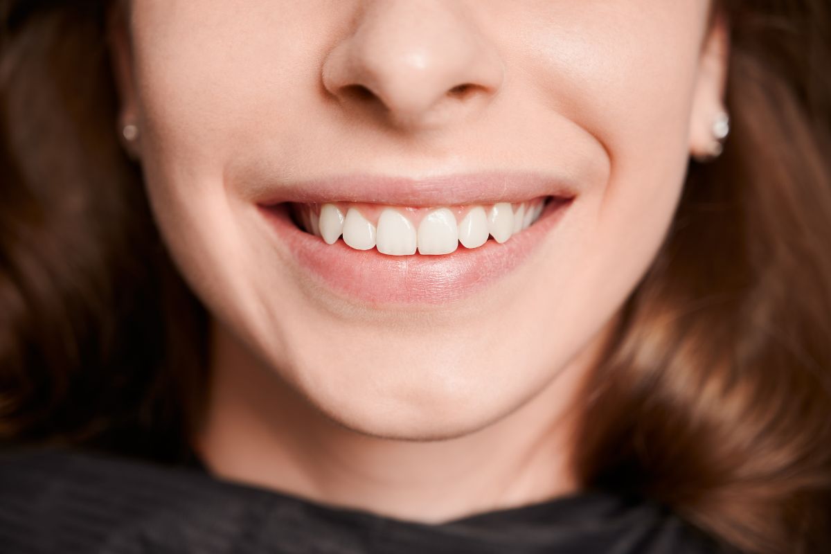 Do You Need an Orthodontist for Gaps Between Teeth